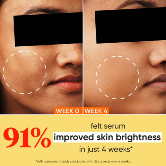 Dot & Key 10% Vitamin C + E Face Serum With 5% Niacinamide, Fights Pigmentation & Dark Spots - Image 3